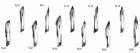 Scalpel Blade Handle N-11 N-3 Box 100U